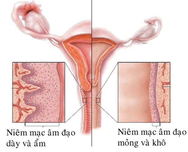 viêm teo âm đạo