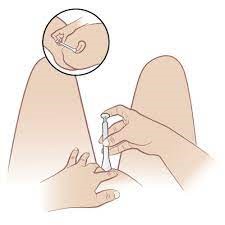 cách đặt thuốc đặt âm đạo