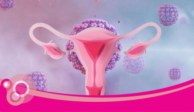 Điều trị viêm âm đạo do vi khuẩn: những điều cần biết