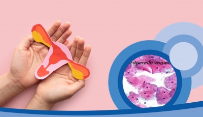 Viêm âm đạo do nấm